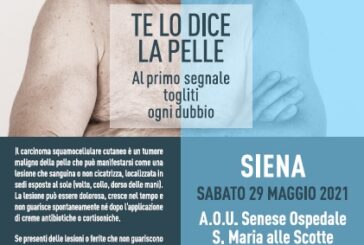 Carcinoma squamocellulare cutaneo: a Siena lo screening gratuito