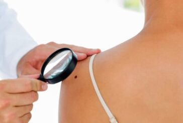 L’Asl Toscana SE promuove la prevenzione da melanoma e tumori della pelle